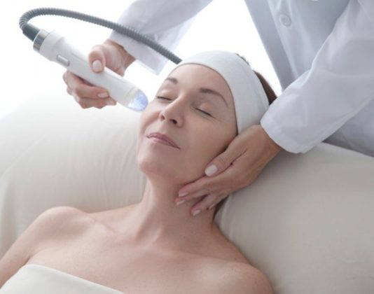 Radiofrequente Microneedling bij Het Laserkabinet in Herentals