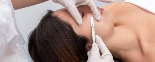 Dermaplanning behandeling bij het Laserkabinet in Herentals